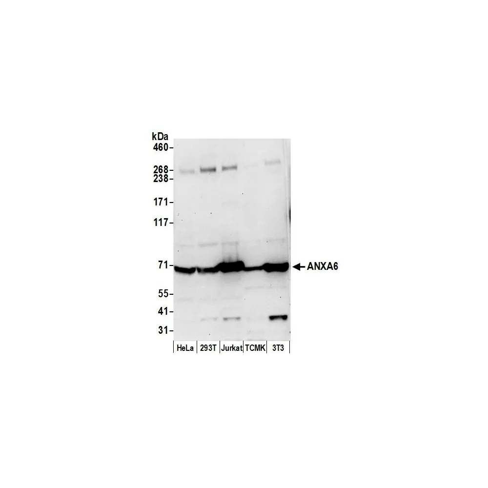 Rabbit anti-ANXA6 Antibody, Affinity Purified