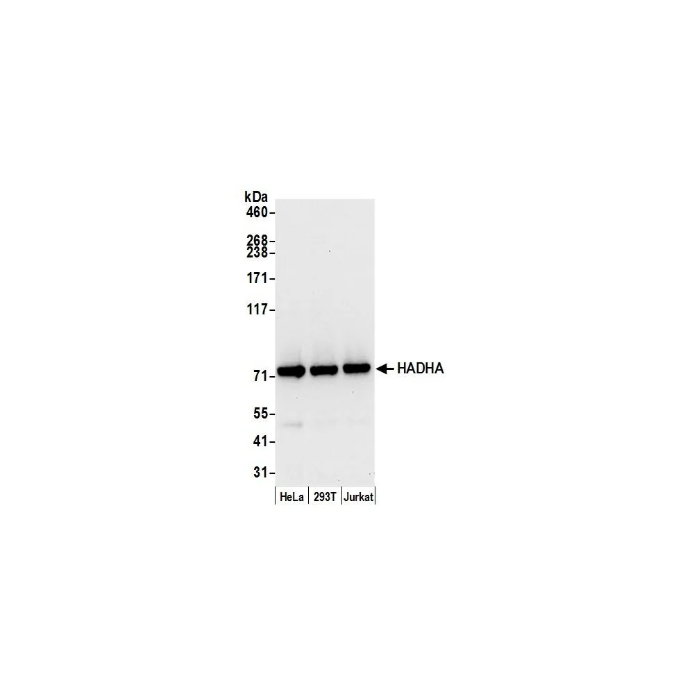 Rabbit anti-HADHA Antibody, Affinity Purified