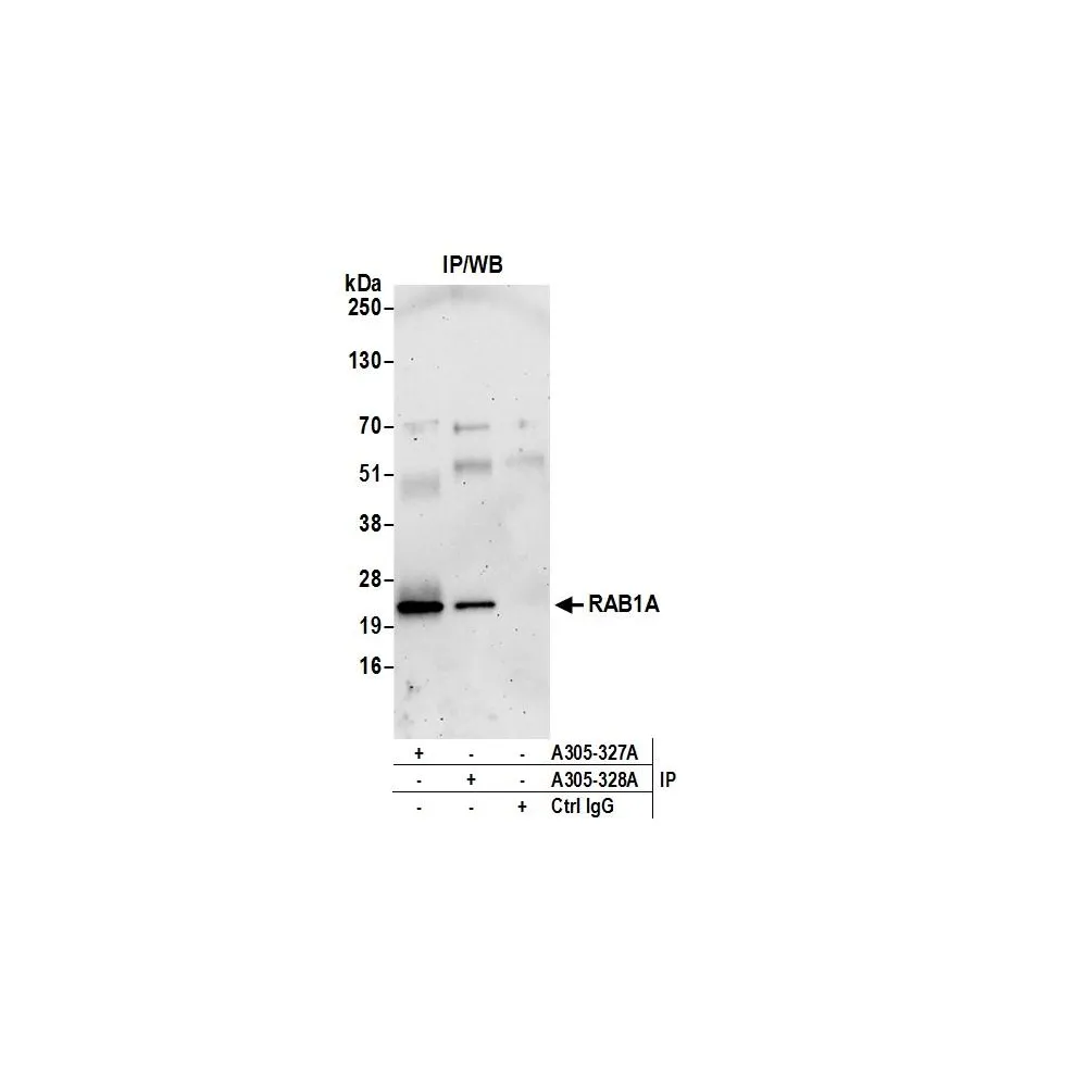 Rabbit anti-RAB1A Antibody, Affinity Purified