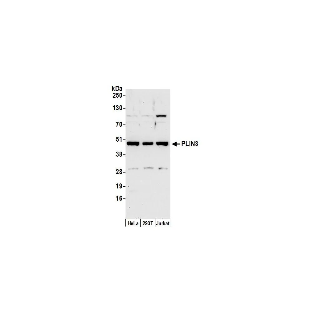 Rabbit anti-PLIN3 Antibody, Affinity Purified