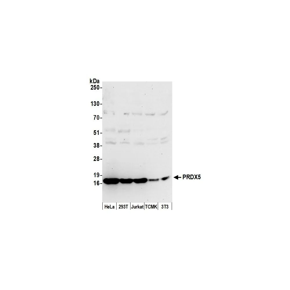 Rabbit anti-PRDX5 Antibody, Affinity Purified