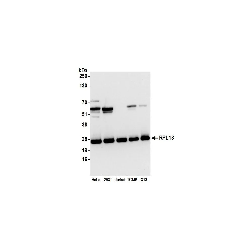 Rabbit anti-RPL18/Ribosomal Protein L18 Antibody, Affinity Purified