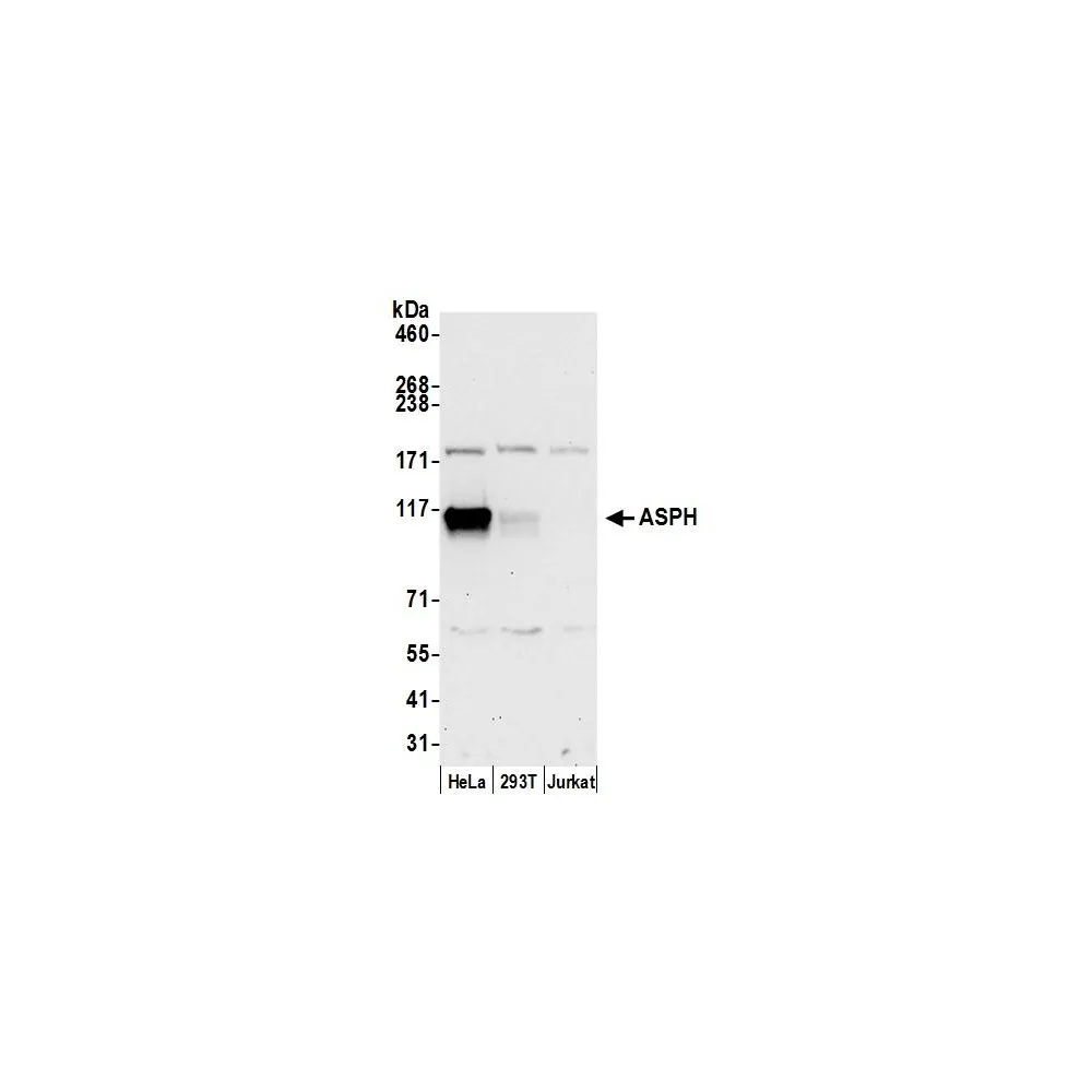 Rabbit anti-ASPH Antibody, Affinity Purified