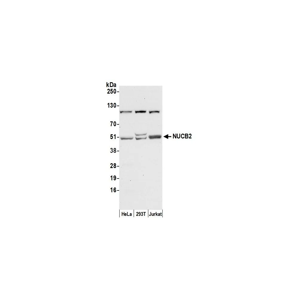 Rabbit anti-NUCB2 Antibody, Affinity Purified