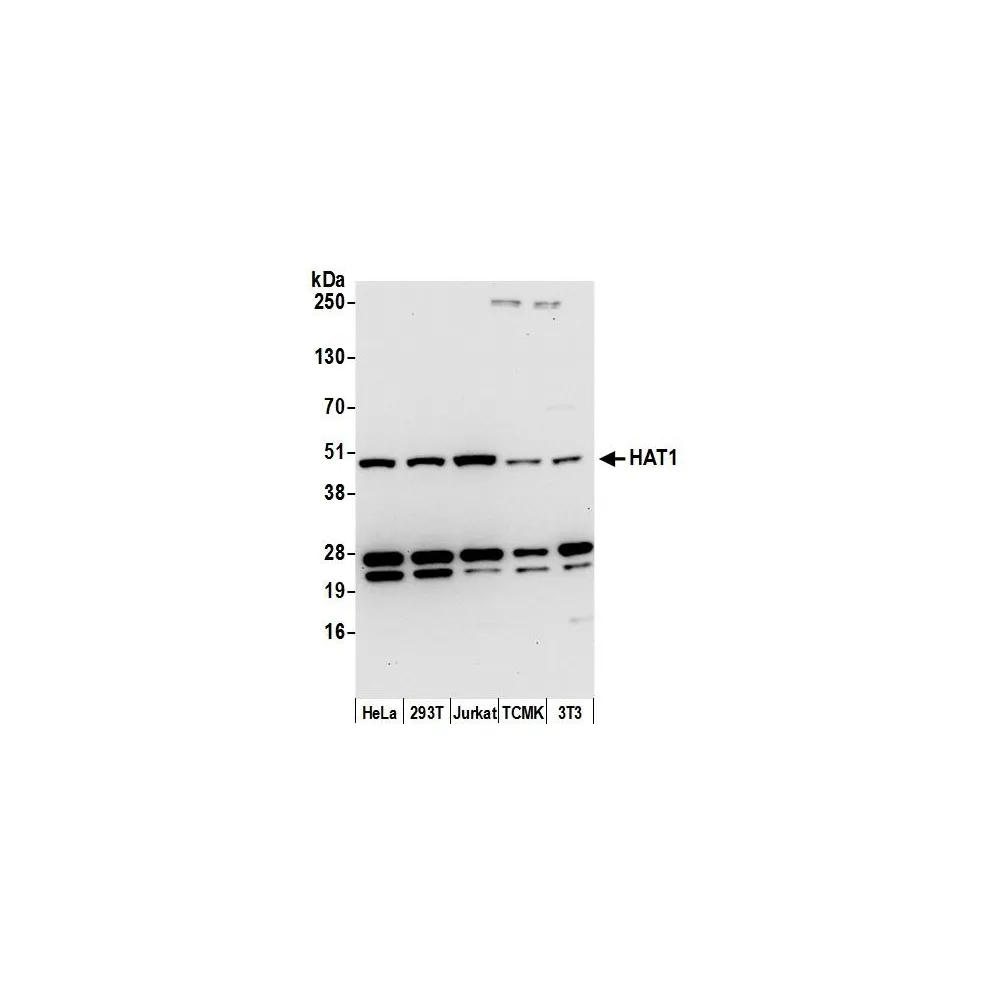 Rabbit anti-HAT1/KAT1 Antibody, Affinity Purified