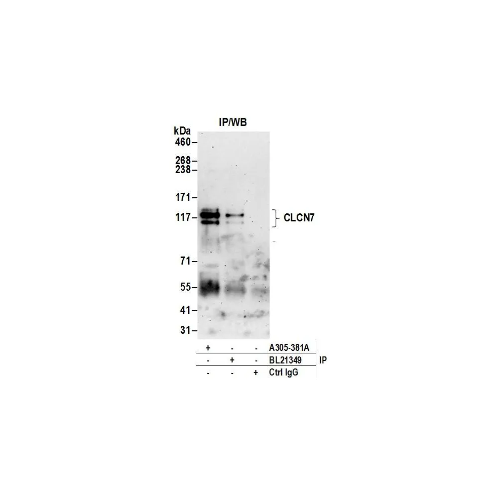Rabbit anti-CLCN7 Antibody, Affinity Purified