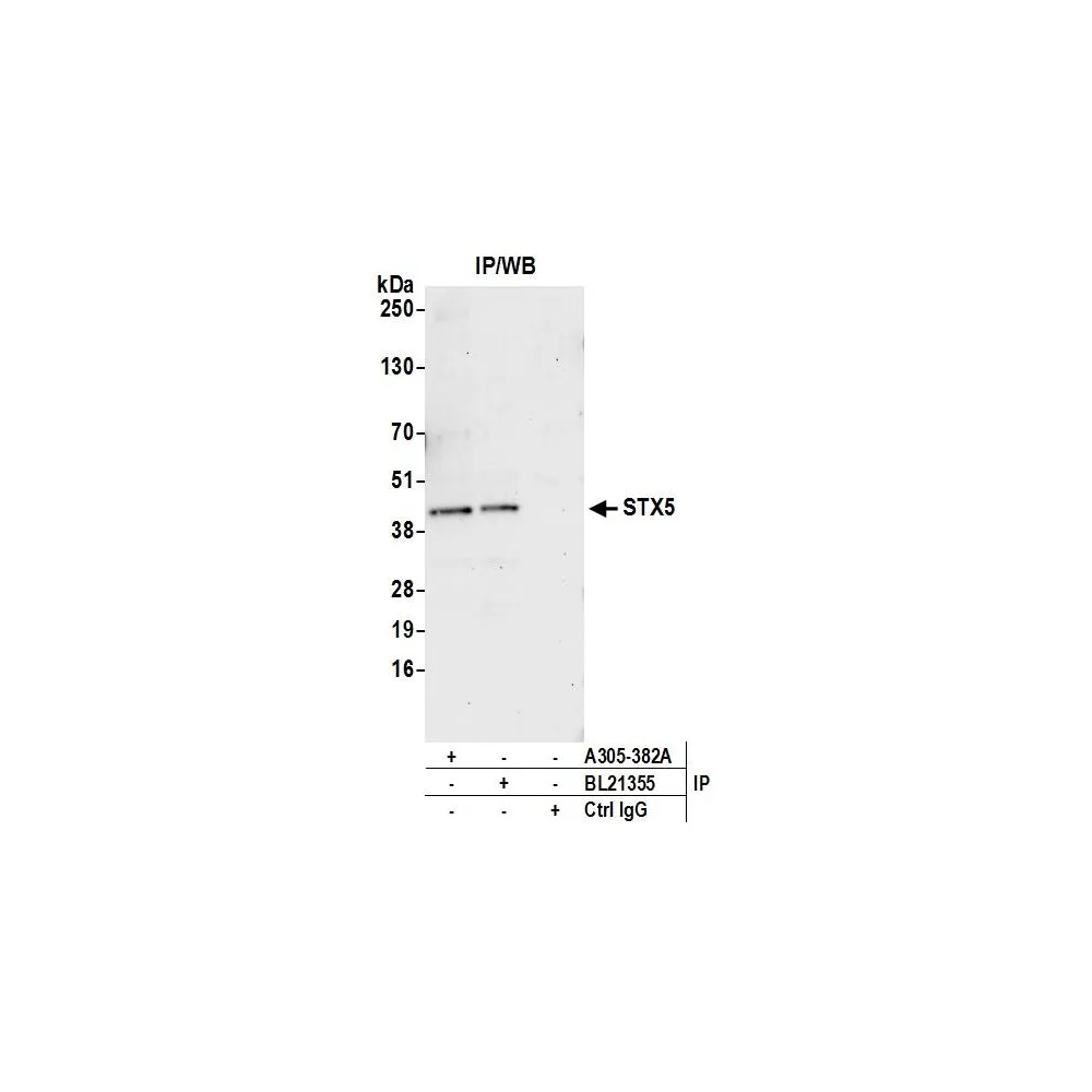 Rabbit anti-STX5 Antibody, Affinity Purified