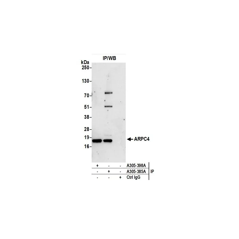 Rabbit anti-ARPC4 Antibody, Affinity Purified