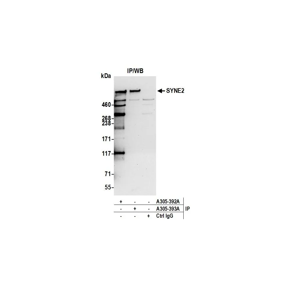 Rabbit anti-SYNE2/Nesprin 2 Antibody, Affinity Purified