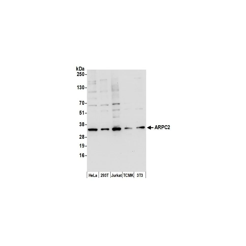 Rabbit anti-ARPC2 Antibody, Affinity Purified