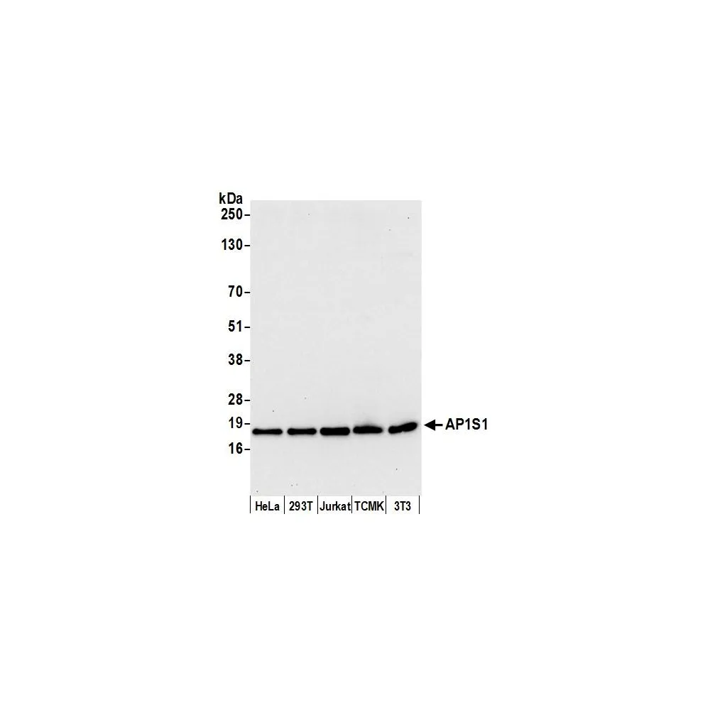 Rabbit anti-AP1S1 Antibody, Affinity Purified