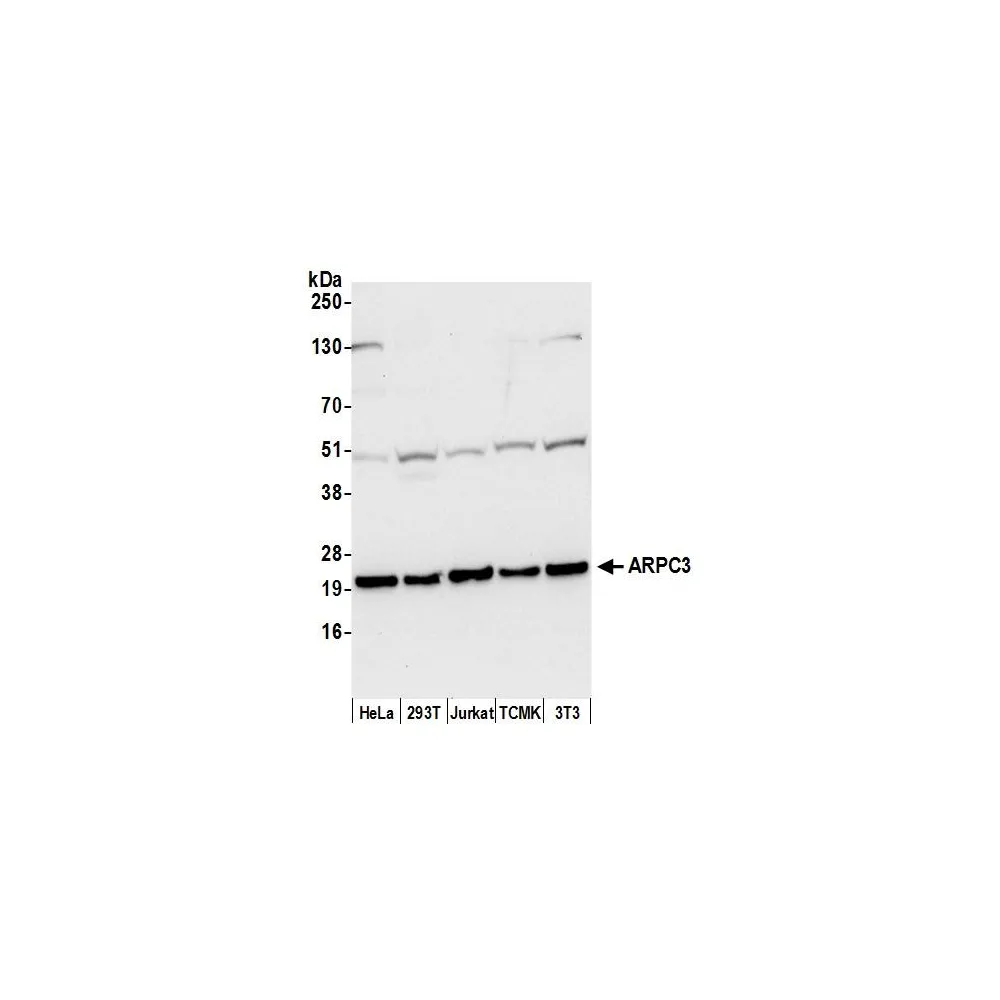 Rabbit anti-ARPC3 Antibody, Affinity Purified