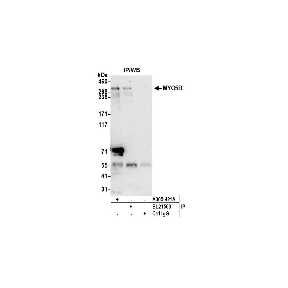 Rabbit anti-MYO5B Antibody, Affinity Purified