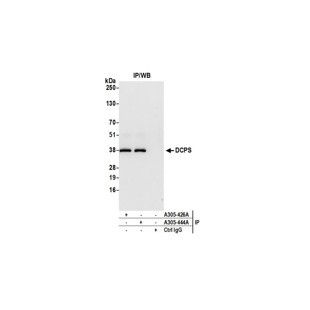 Rabbit anti-DCPS Antibody, Affinity Purified