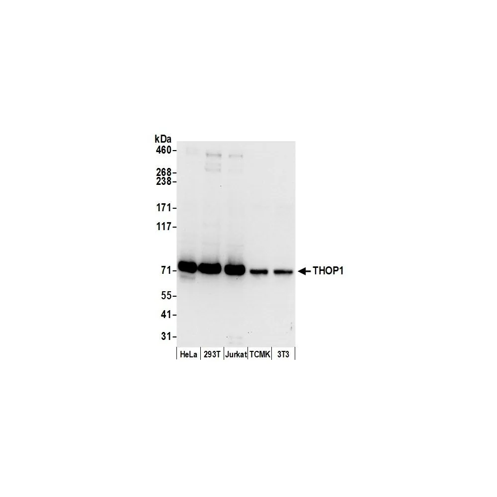 Rabbit anti-THOP1 Antibody, Affinity Purified