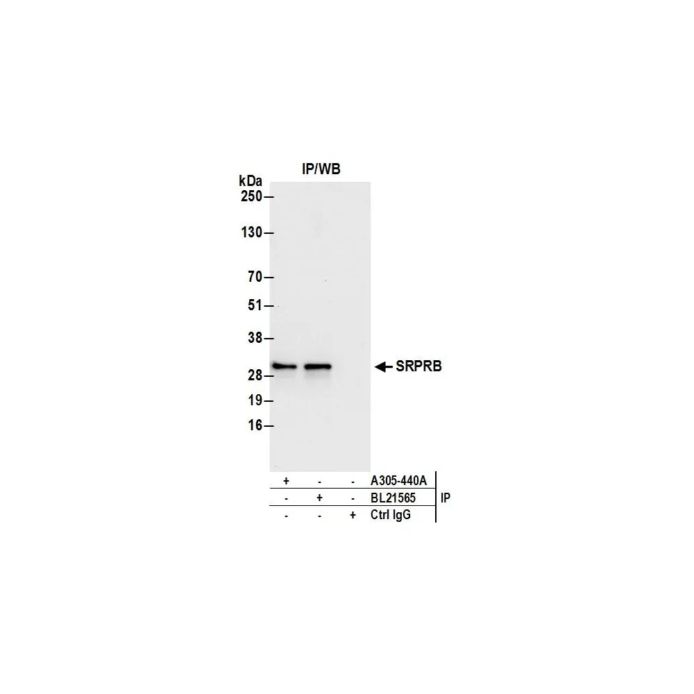 Rabbit anti-SRPRB Antibody, Affinity Purified