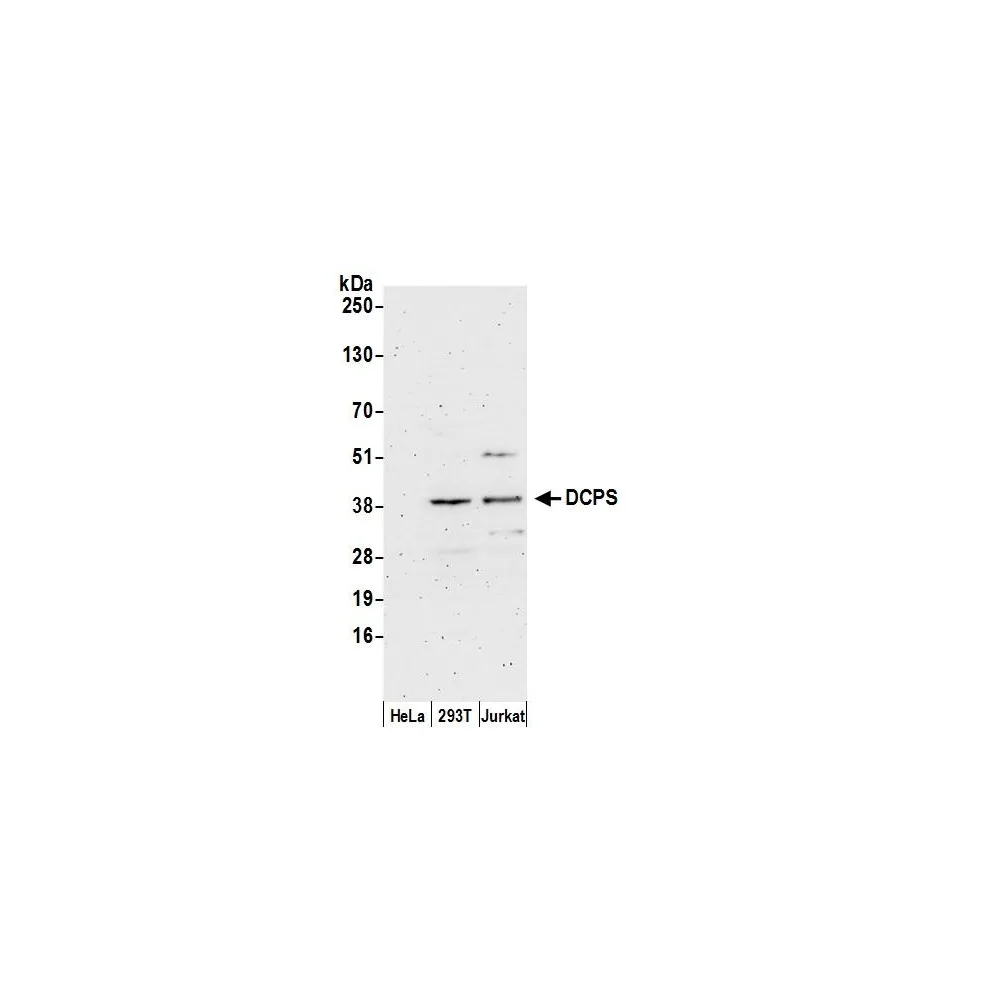 Rabbit anti-DCPS Antibody, Affinity Purified