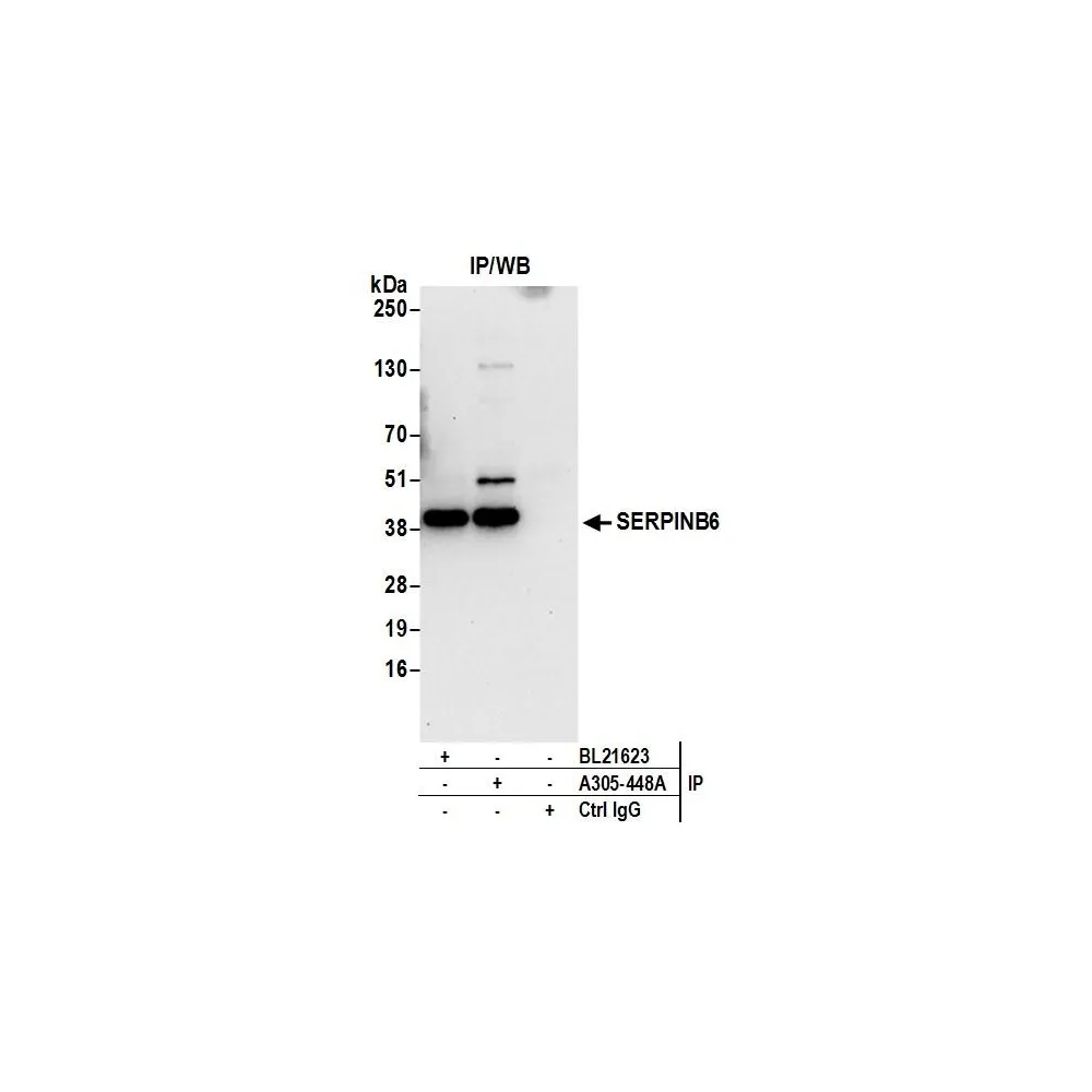 Rabbit anti-SERPINB6 Antibody, Affinity Purified