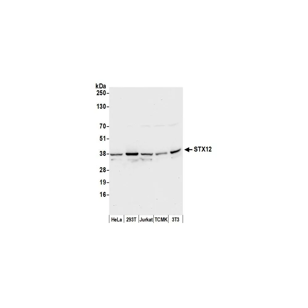 Rabbit anti-STX12 Antibody, Affinity Purified
