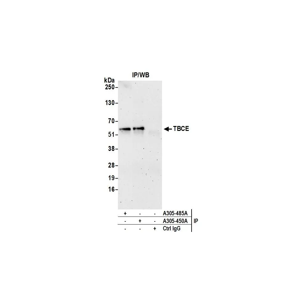 Rabbit anti-TBCE Antibody, Affinity Purified