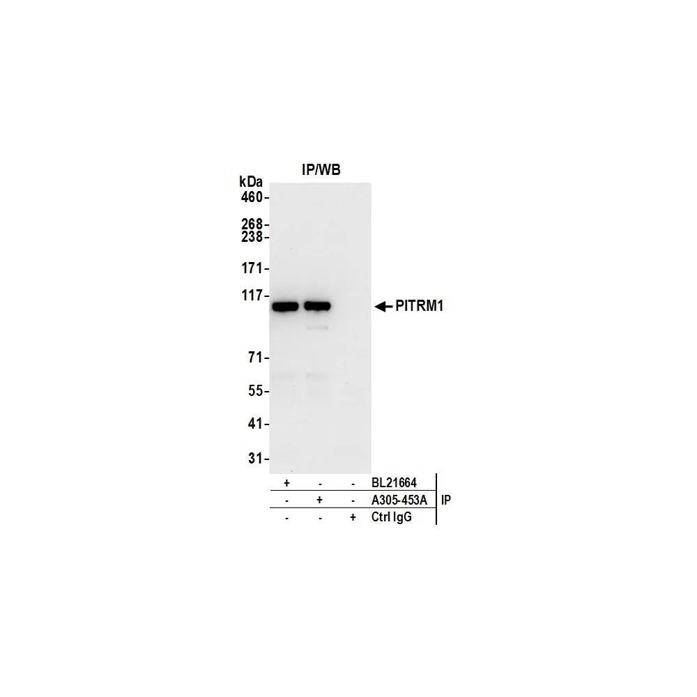 Rabbit anti-PITRM1 Antibody, Affinity Purified