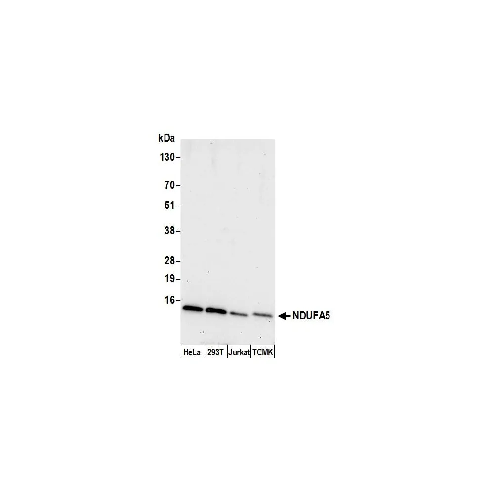 Rabbit anti-NDUFA5 Antibody, Affinity Purified
