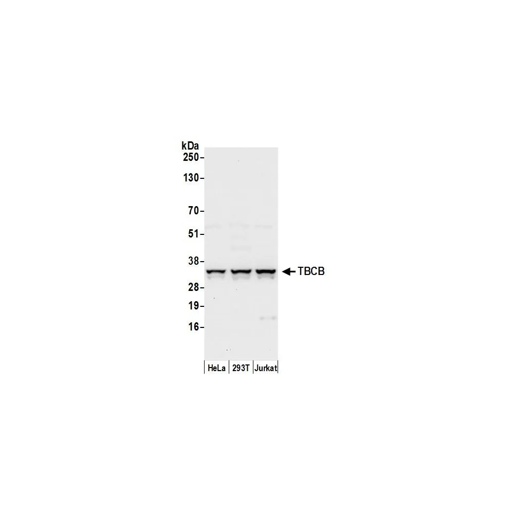 Rabbit anti-TBCB Antibody, Affinity Purified