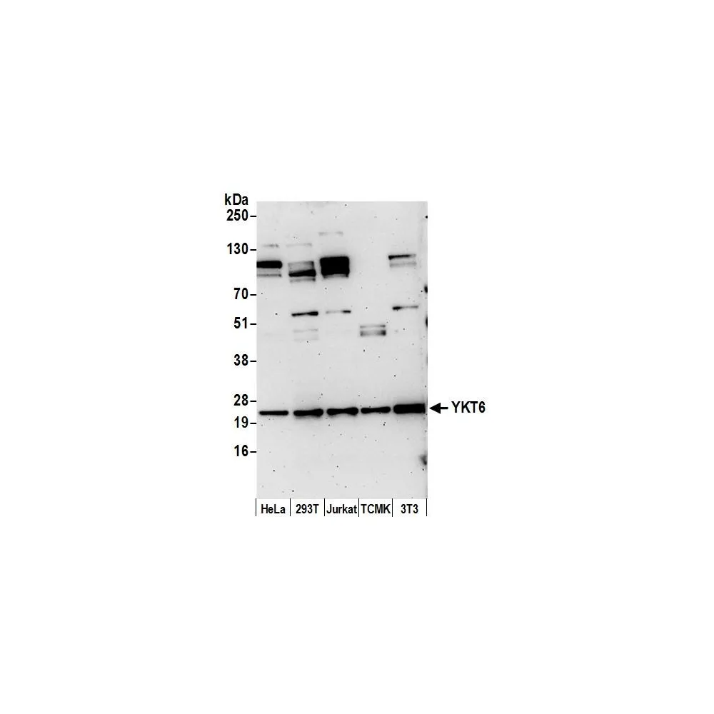 Rabbit anti-YKT6 Antibody, Affinity Purified