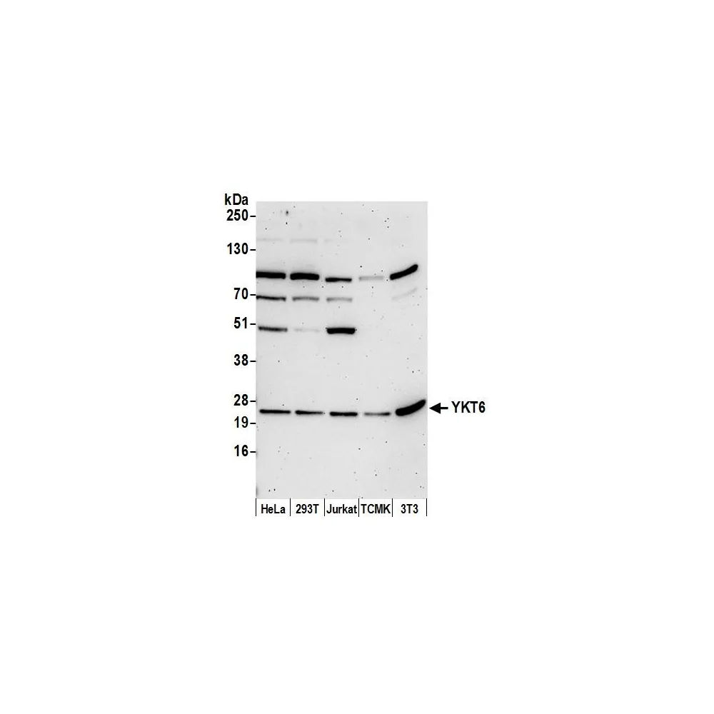 Rabbit anti-YKT6 Antibody, Affinity Purified