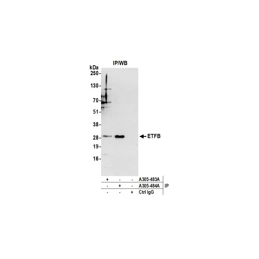 Rabbit anti-ETFB Antibody, Affinity Purified