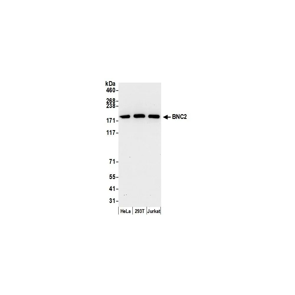 Rabbit anti-BNC2 Antibody, Affinity Purified