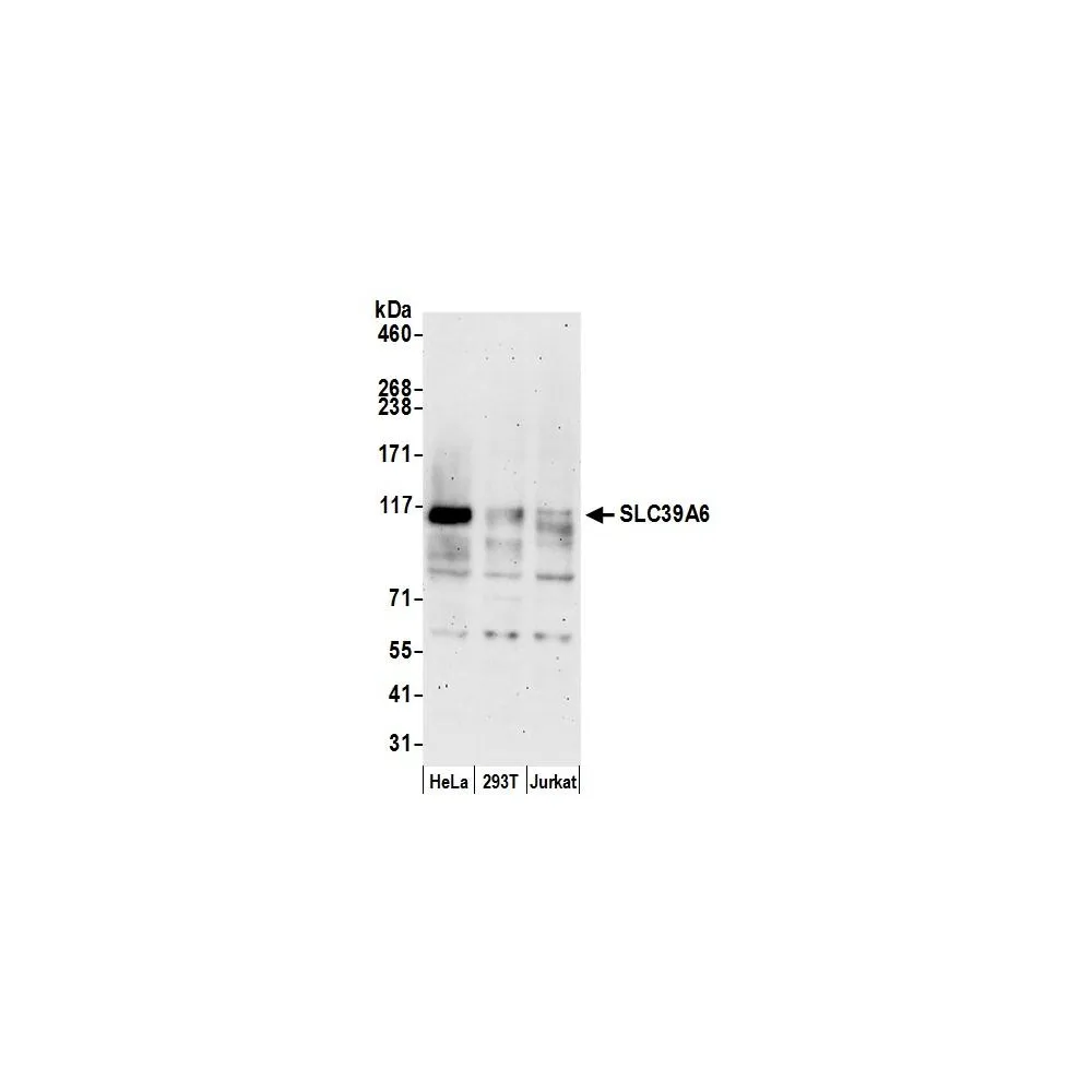 Rabbit anti-SLC39A6 Antibody, Affinity Purified