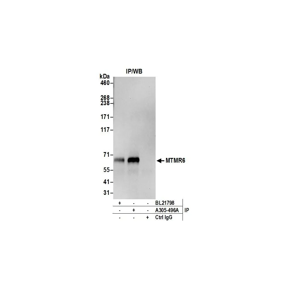 Rabbit anti-MTMR6 Antibody, Affinity Purified