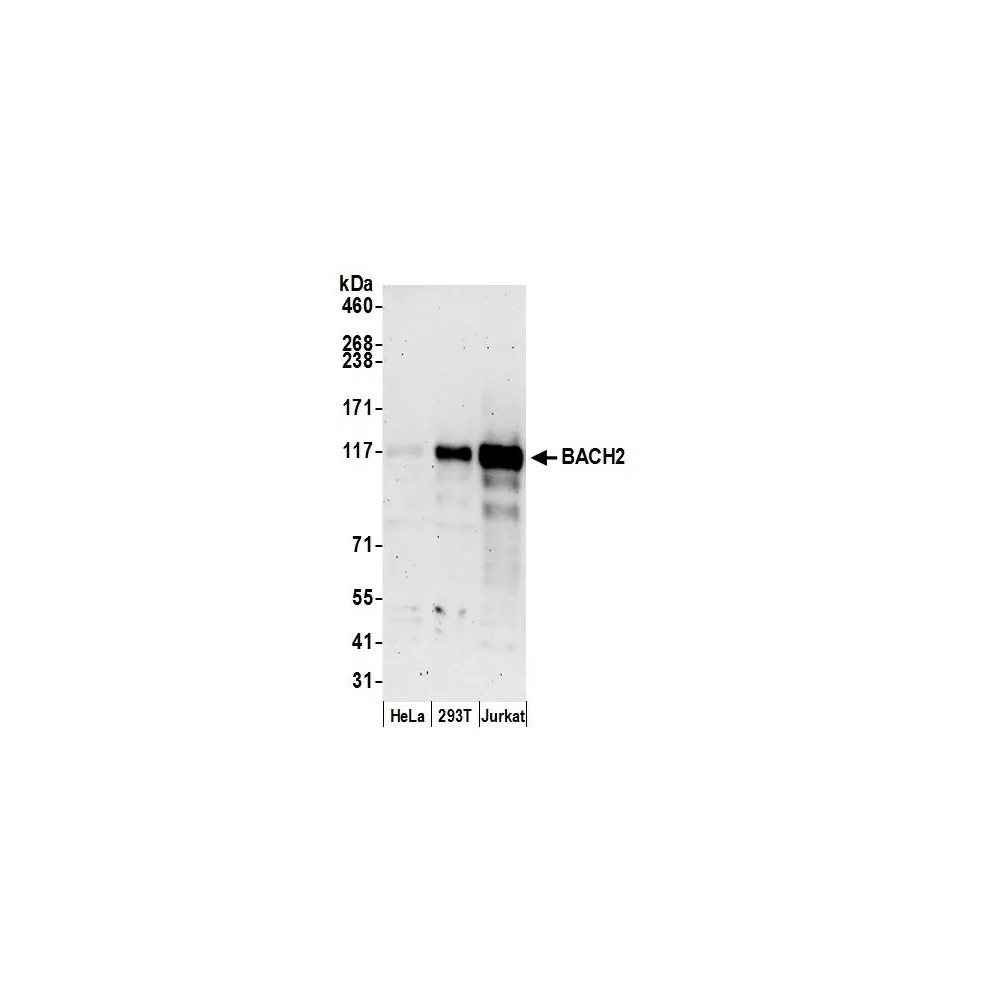 Rabbit anti-BACH2 Antibody, Affinity Purified