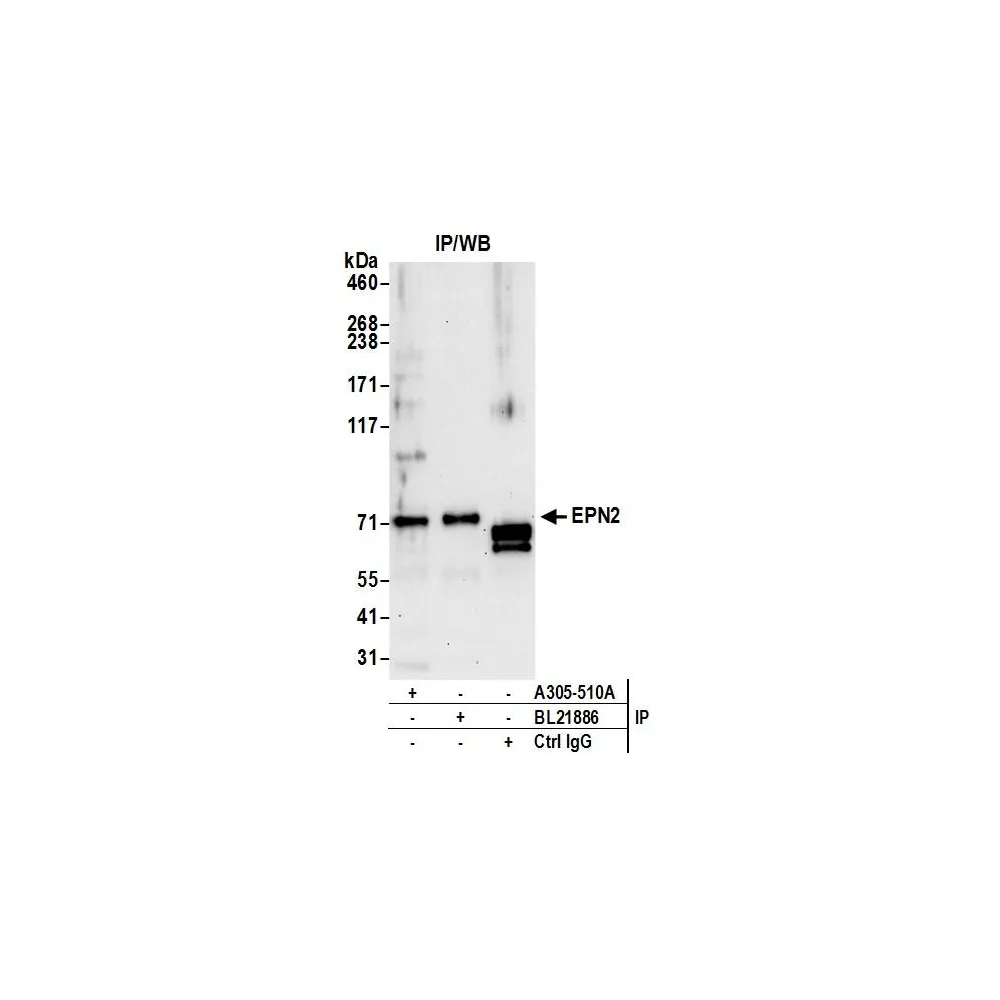 Rabbit anti-EPN2 Antibody, Affinity Purified