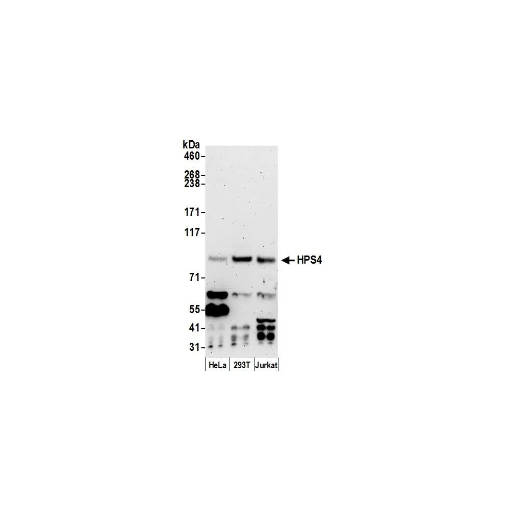 Rabbit anti-HPS4 Antibody, Affinity Purified