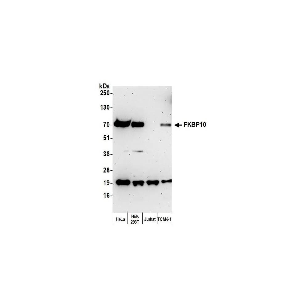 Rabbit anti-FKBP10 Antibody, Affinity Purified