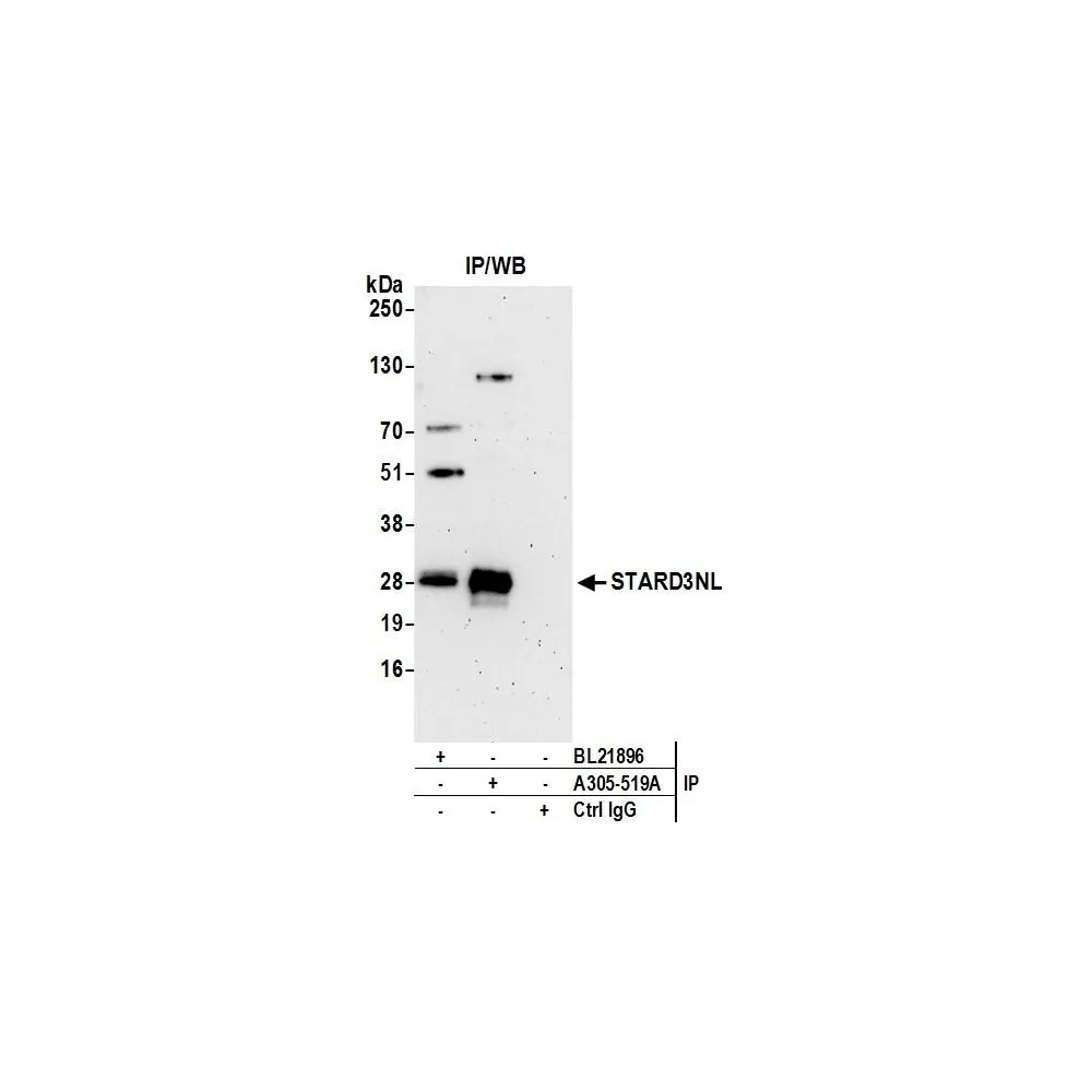 Rabbit anti-STARD3NL Antibody, Affinity Purified