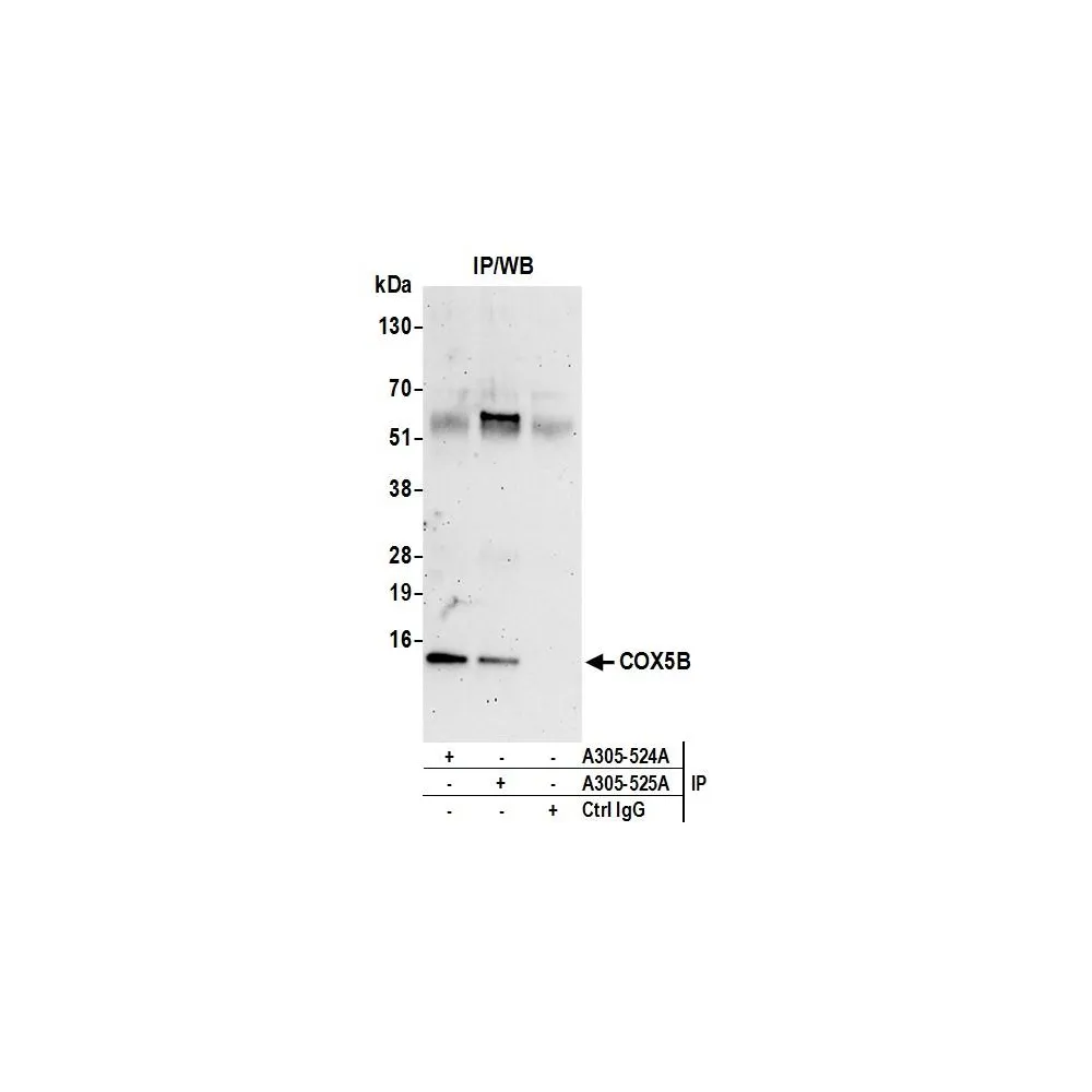 Rabbit anti-COX5B Antibody, Affinity Purified