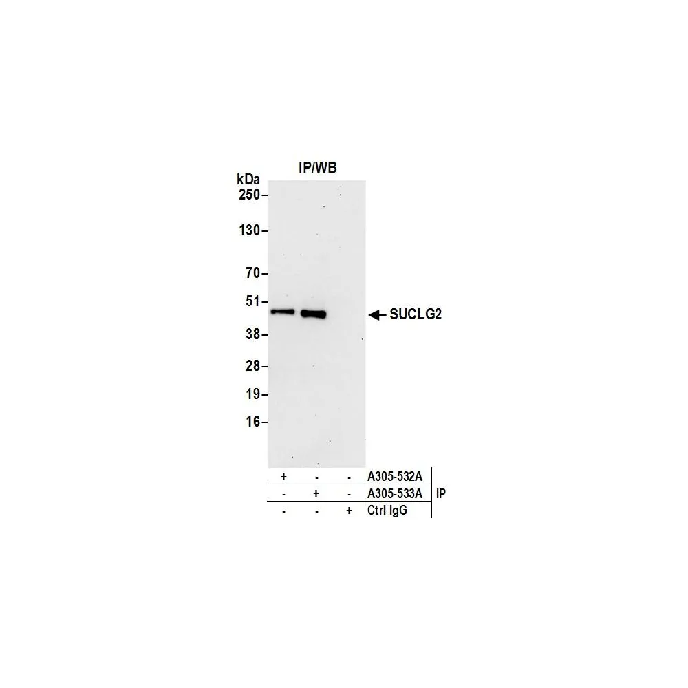 Rabbit anti-SUCLG2 Antibody, Affinity Purified