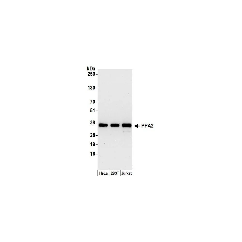 Rabbit anti-PPA2 Antibody, Affinity Purified