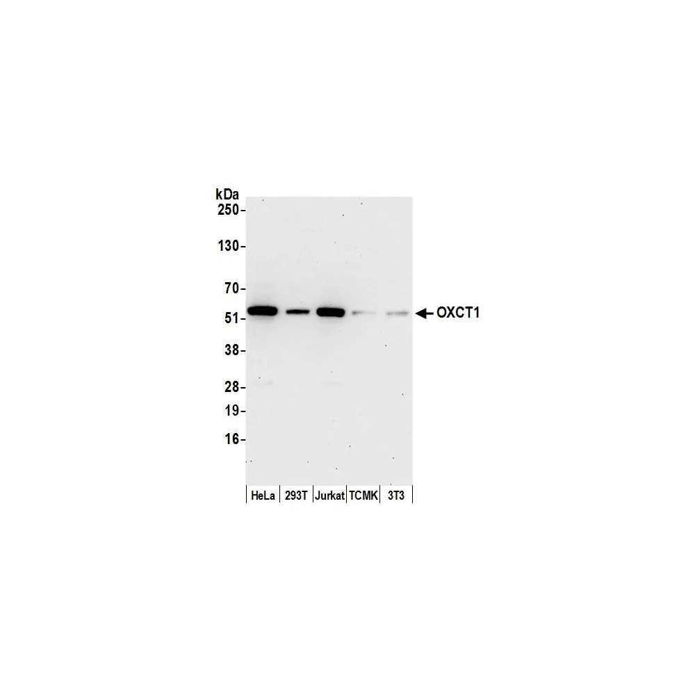 Rabbit anti-OXCT1 Antibody, Affinity Purified