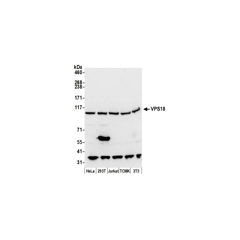 Rabbit anti-VPS18 Antibody, Affinity Purified