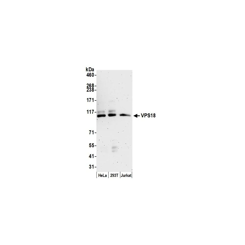 Rabbit anti-VPS18 Antibody, Affinity Purified