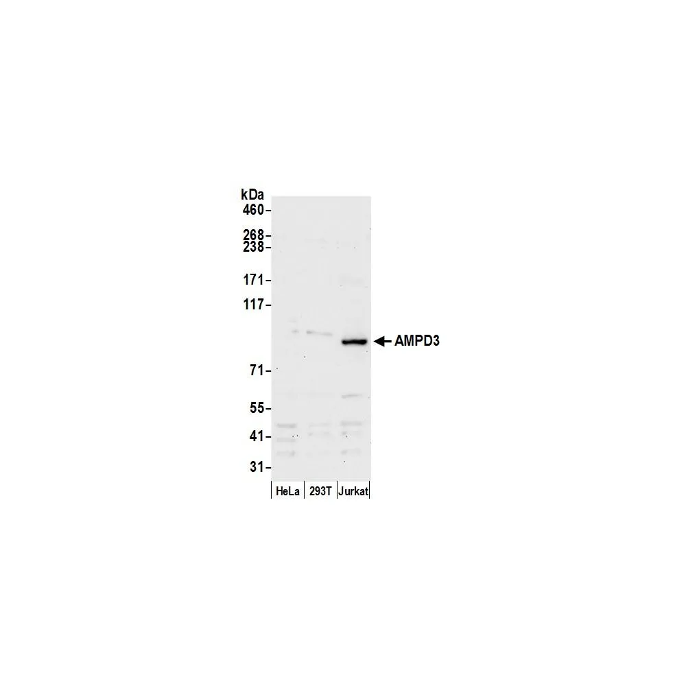 Rabbit anti-AMPD3 Antibody, Affinity Purified