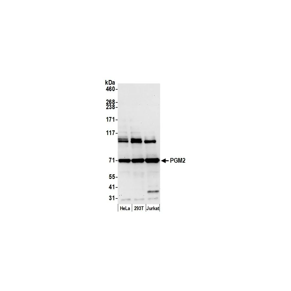 Rabbit anti-PGM2 Antibody, Affinity Purified