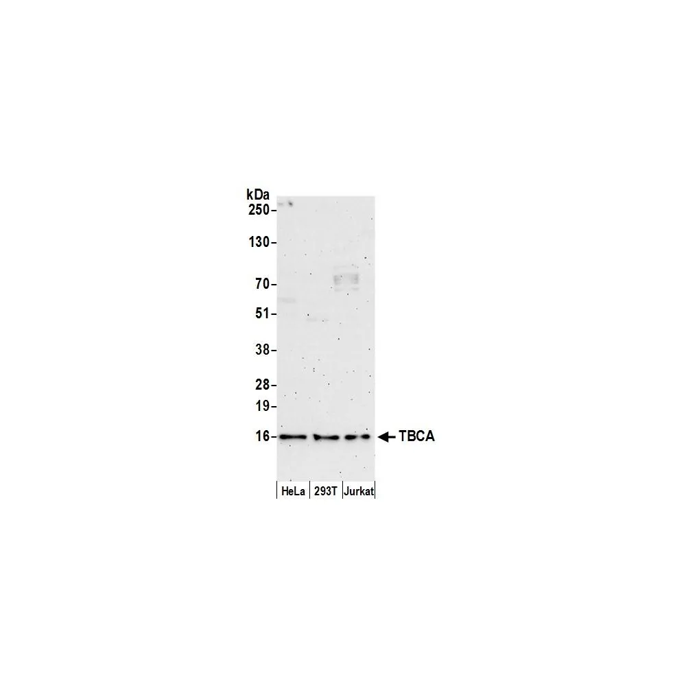 Rabbit anti-TBCA Antibody, Affinity Purified