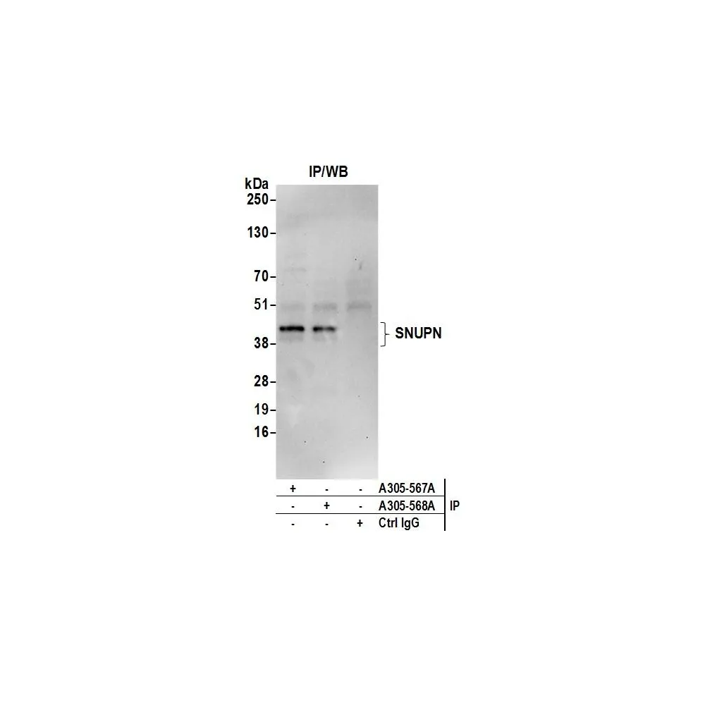 Rabbit anti-SNUPN Antibody, Affinity Purified