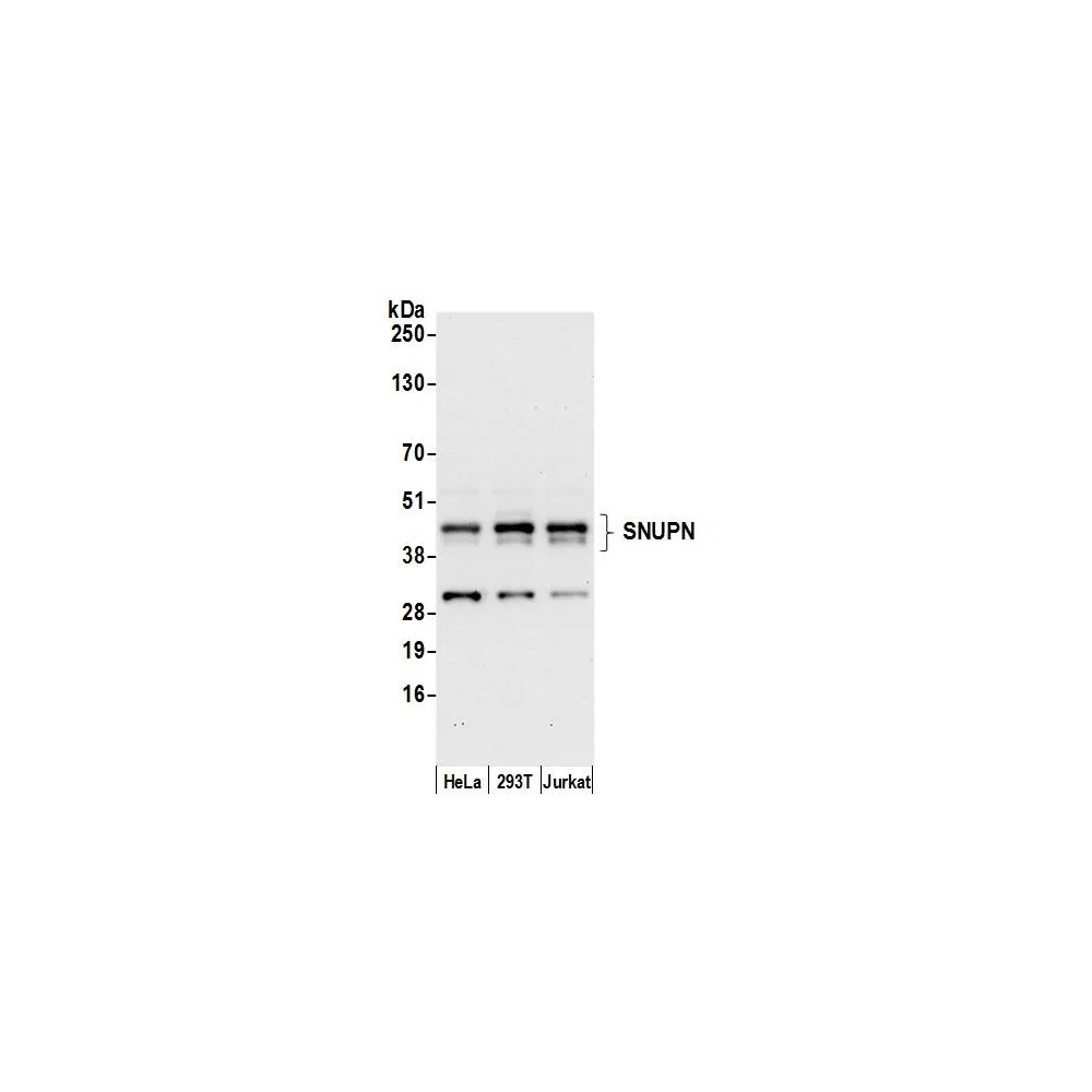 Rabbit anti-SNUPN Antibody, Affinity Purified