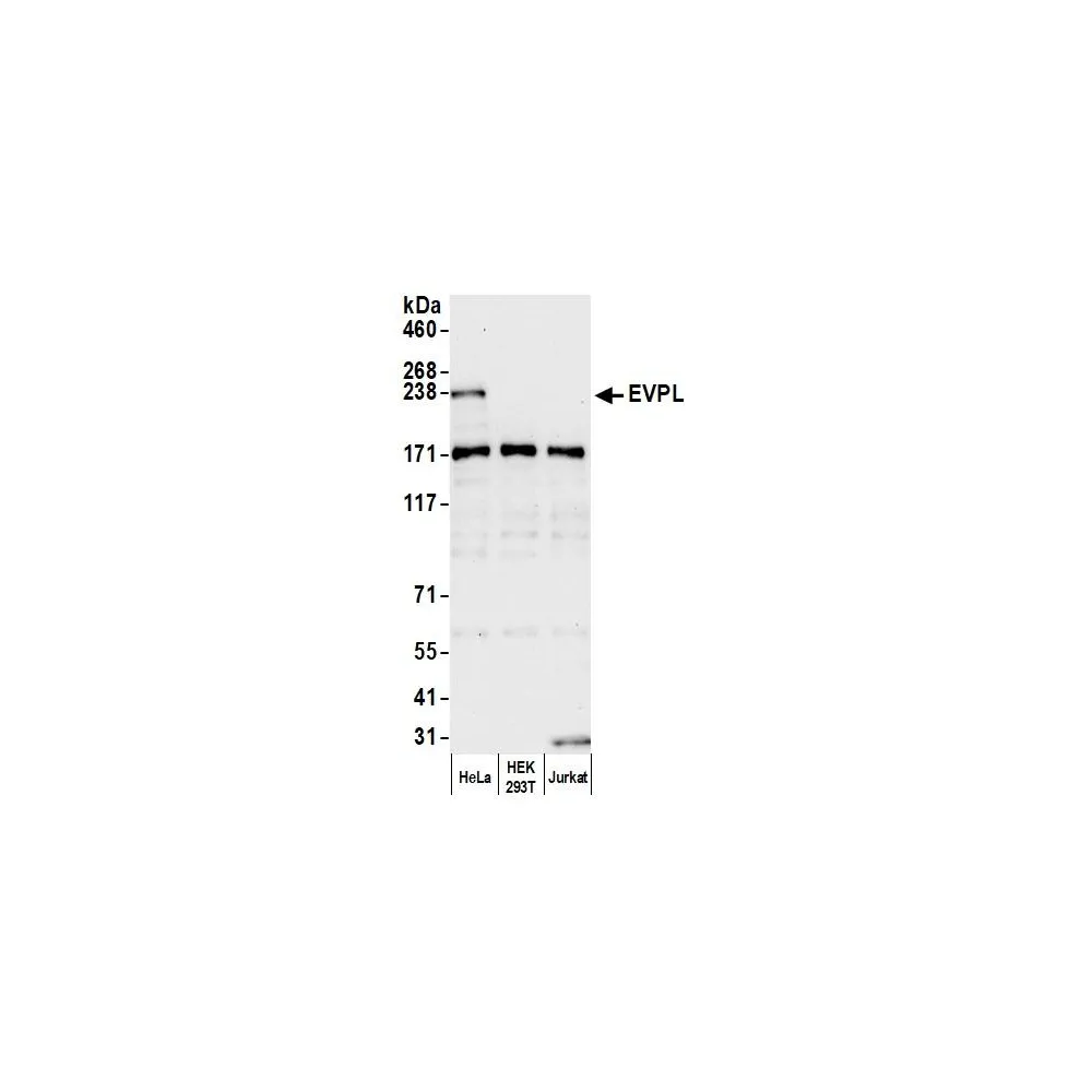 Rabbit anti-EVPL Antibody, Affinity Purified